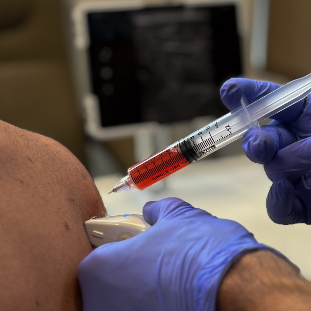 Person receiving an injection with a syringe in a medical setting.